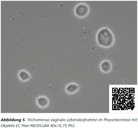 Abbildung 5 Trichomonas vaginalis Lebendaufnahme im Phasenkontrast mit Objektiv EC Plan-NEOFLUAR 40x / 0,75 Ph2